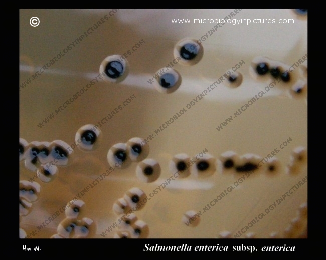 salmonella colonies on salmonella-shigella agar, close-up